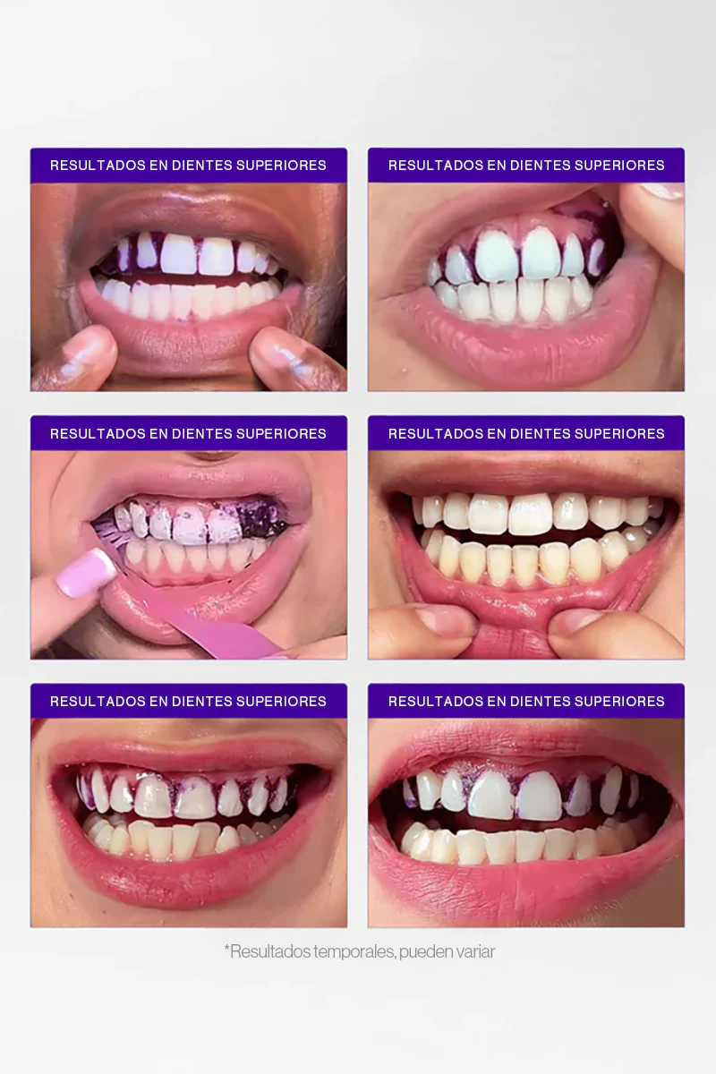 2x1 - MAGIC STRIPS V34 - Tiras blanqueadoras