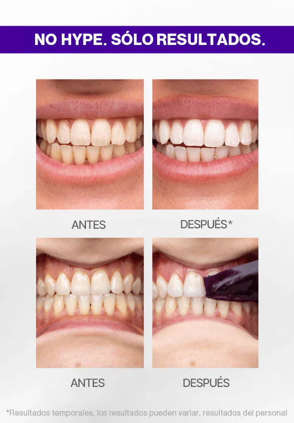 2x1 - MAGIC STRIPS V34 - Tiras blanqueadoras